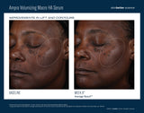 Ampra Volumiving Macro HA Serum
