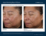 Ampra Volumiving Macro HA Serum