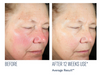 Even Intensive Serum